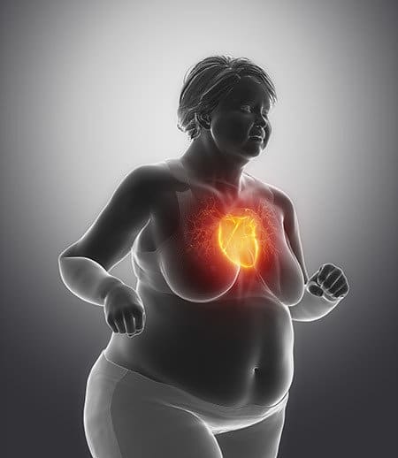 Health Issues Related With Obesity 2