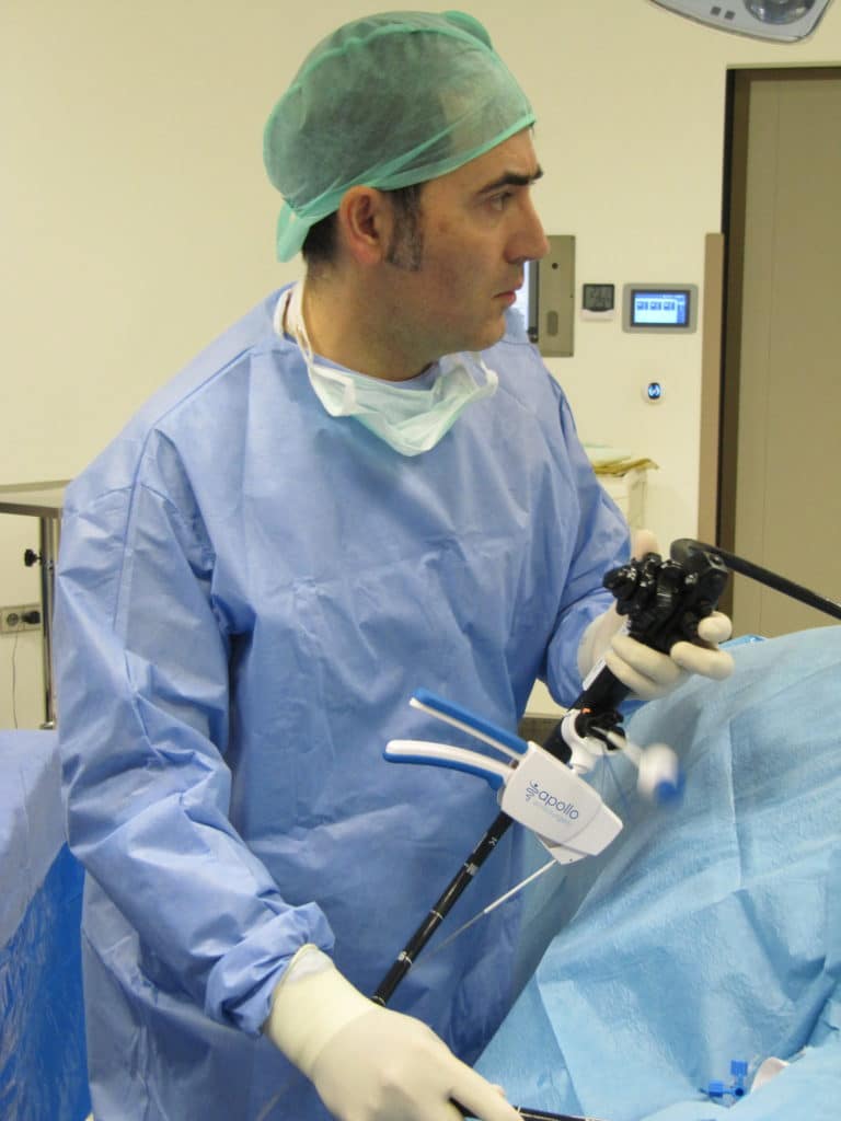 Apollo Endoscopic Sleeve Murat Ustun